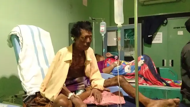 Pria dengan Tubuh Penuh Nanah