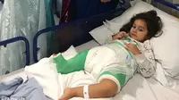 Balita Terlahir dengan Kaki Setengah Kecil