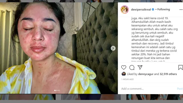 Dewi Perssik