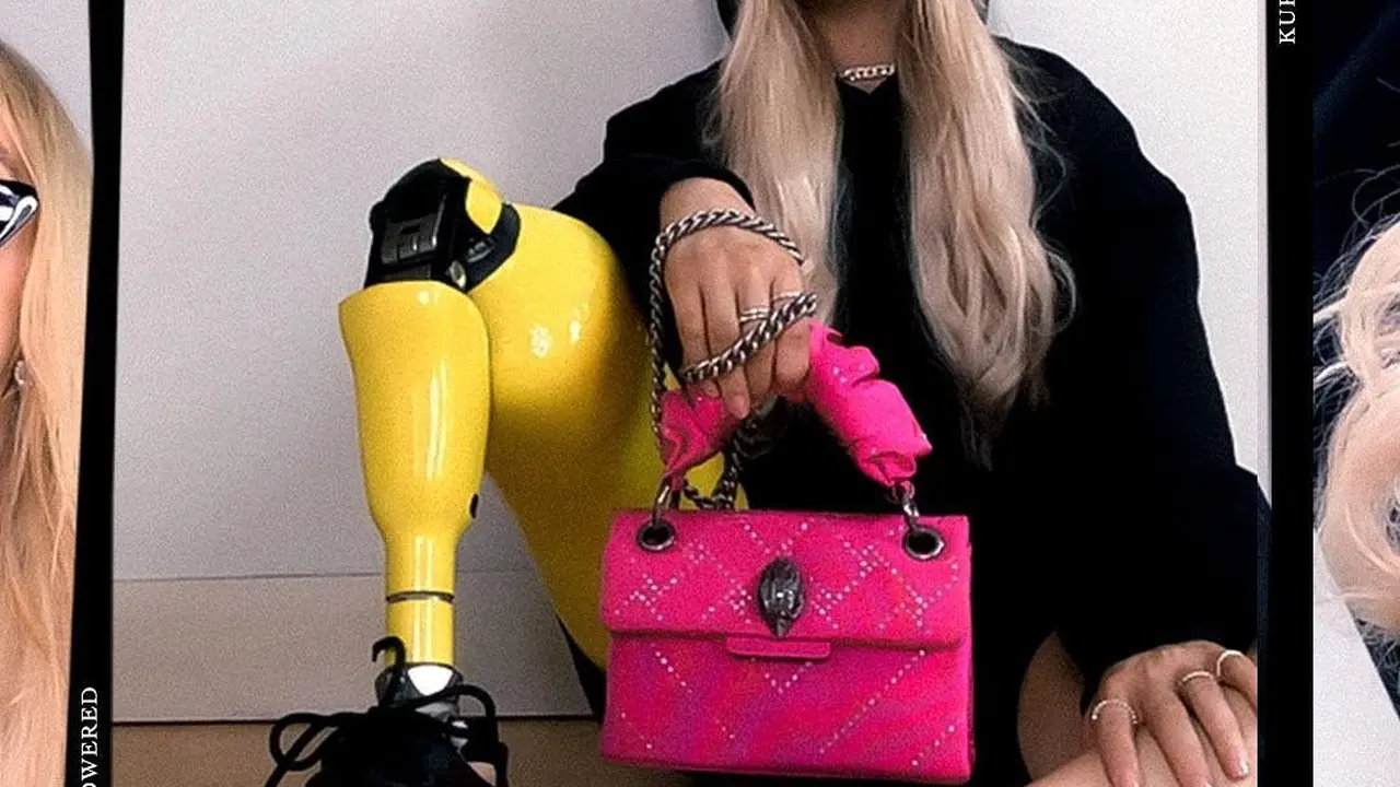 Dengan Satu Kaki, Penderita Kanker Ini Dipilih Jadi Model Kurt Geiger