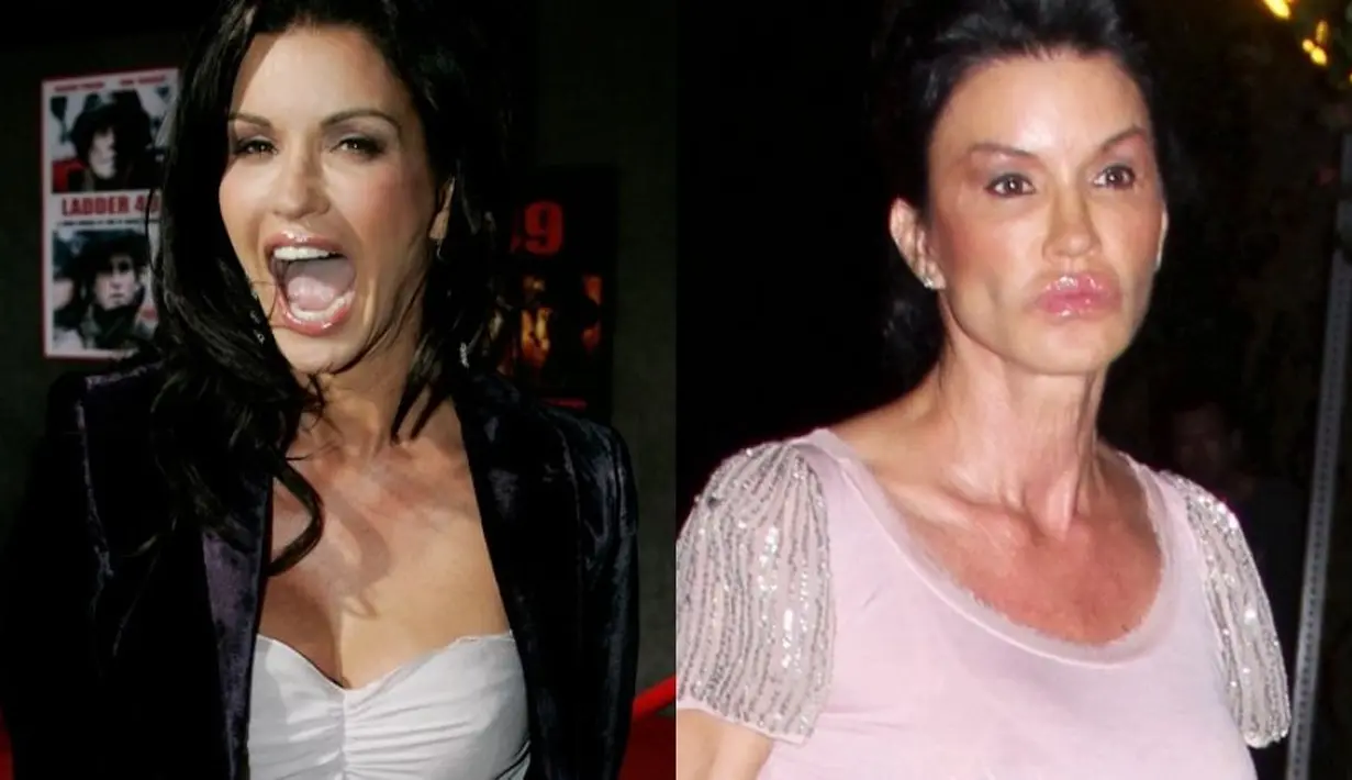 Janice Dicksinson sudah miliki wajah cantik sedari dulu. Namun sayang, mantan supermodel ini malah terlihat aneh usai operasi plastik. (FoxNews)