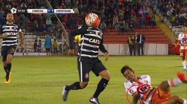 Gelandang asal Argentina Jonathan Benitez menderita salah satu cedera sepak bola terburuk yang pernah kita lihat ketika Cobresal kalah melawan Corinthians 0-1