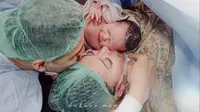 Alasan Asmirandah Bedah Cesar, Dokter Sebut Posisi Janin Sungsang dengan Lilitan Satu Tali Pusat di Leher