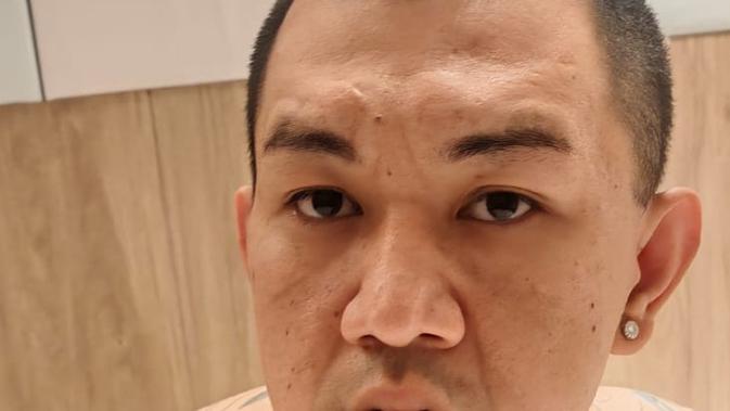 Polisi Tangkap 'The Doctor', Bandar Narkoba Jaringan Ko Erwin yang Terlibat Kasus di White Rabbit