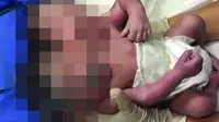 Bayi berkepala dua di Meksiko. (CEN)