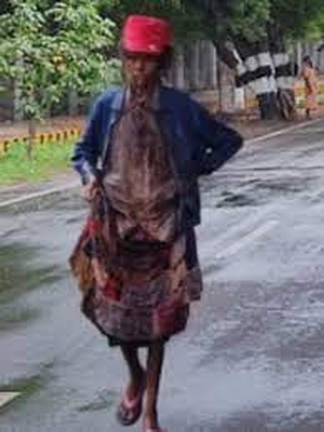 Kehidupan Topi Amma Sebelum Menjadi Simbol Tiruvannamalai