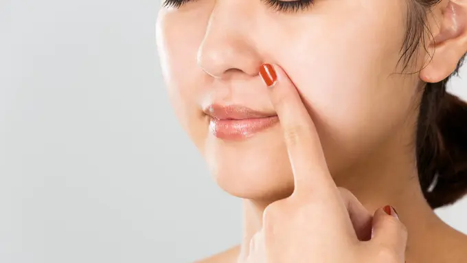 4 Langkah Efektif Atasi Blackhead, Si Komedo Hitam yang Mengganggu Penampilan