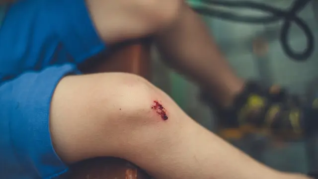 Ilustrasi pembekuan darah