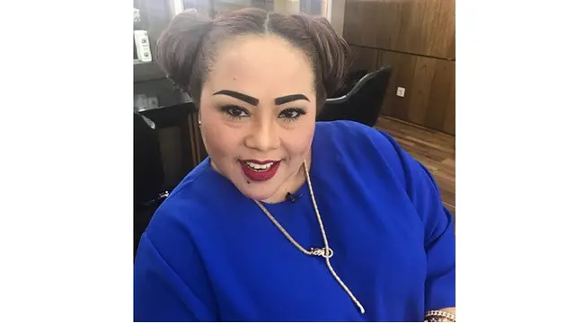 Rambut Mulai Rontok Pasca Kemoterapi, Ini 6 Potret Nunung Pakai Turban dan Wig