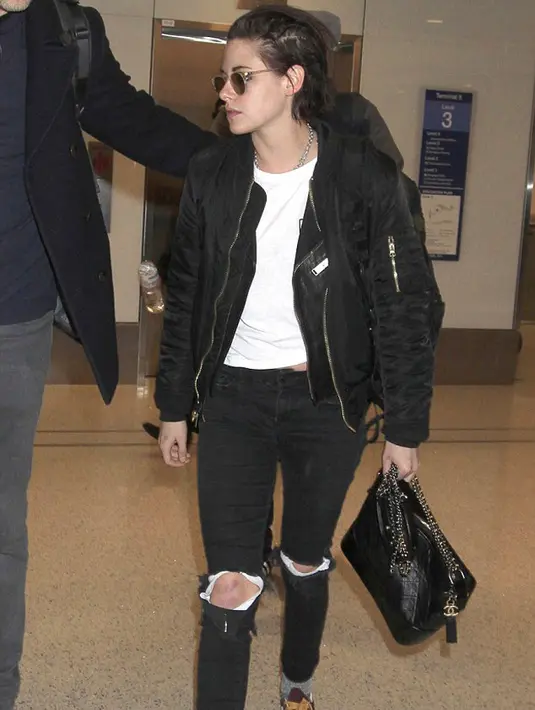 Bekas luka di lutut Stewart itu memang terlihat sangat mengerikan, dan tak heran jika hal ini menjadi perhatian publik. Selain itu, ia juga mengatakan pada dailymail tidak peduli dengan pandangan orang tentang dirinya. (doc.dailymail.com)