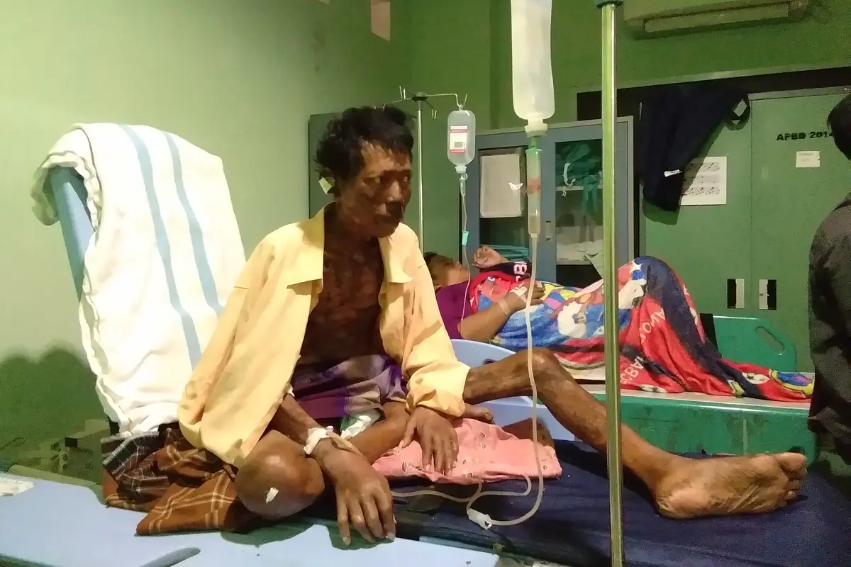 Pria dengan Tubuh Penuh Nanah