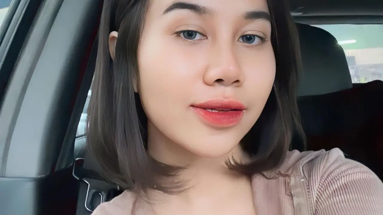 8 Potret Perubahan Wajah Mayang Usai Operasi Hidung, Sudah Lepas Perban