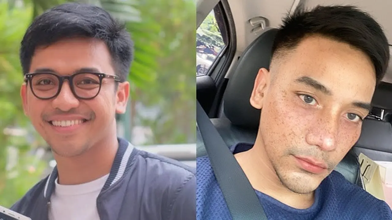 Ungkap Alasan Operasi Plastik, Ini 6 Potret Terbaru Bubah Alfian yang Bikin Pangling