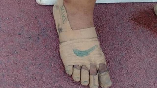 Bintangbola - Pakai Sepatu Perban Saat Lomba Lari, Bocah 11 Tahun Rebut 3 Medali Emas