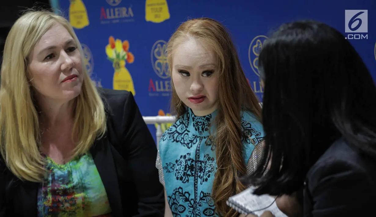 Model Madeline Stuart didampingi Ibunya Rosanne saat diwawancarai Liputan6.com di Alleira Batik Plaza Indonesia, Jakarta, Rabu (20/3). Madeline adalah model penderita down syndrome pertama asal Australia. (Liputan6.com/Faizal Fanani)