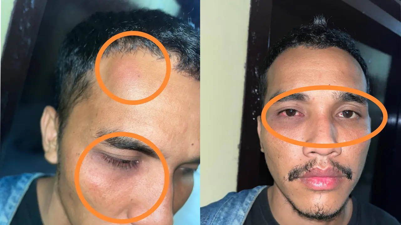 Pria di Kendari Disekap dan Disiksa dalam Arena Biliar Diduga Milik Perwira Polisi