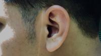 Ilustrasi gangguan pendengaran. Foto (Ade Nasihudin/Liputan6.com).