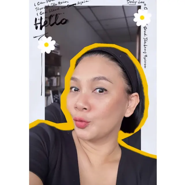 6 Potret Dian Nitami Pasca 3 Minggu Oplas Face Lifting, Kerutan Wajah Berkurang