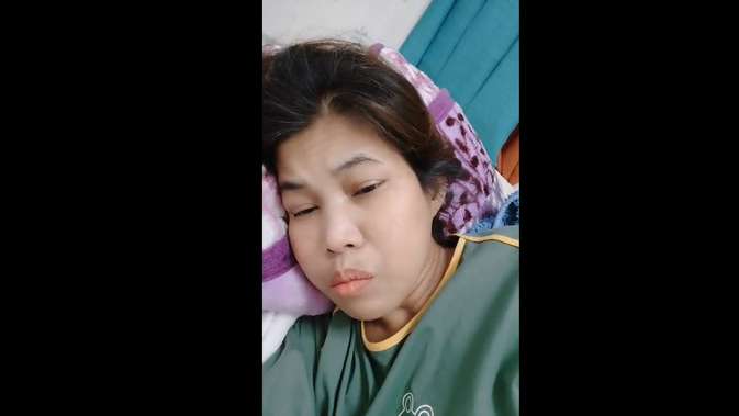 Korban TPPO Asal Sukabumi di China Minta Tolong Gubernur Jabar: Badan Saya Bengkak