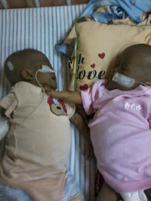 Si kembar Mikhayla dan Cellista |  copyright gimmegaiety.blogspot.com