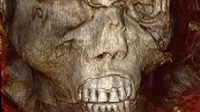 Gambar selebaran yang dirilis oleh Kementerian Pariwisata dan Purbakala Mesir pada 17 Februari 2021 menunjukkan pemindaian 3D dari kepala mumi raja Mesir kuno Seqenenre Taa II. Firaun Seqenenre Taa II dijuluki "Pemberani". (Egyptian Ministry of Antiquities/AFP)