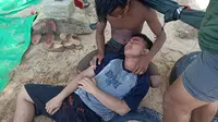 Salah satu pengunjung yang menjadi korban sengatan ubur-ubur saat berenang di Pantai Manggar Balikpapan.