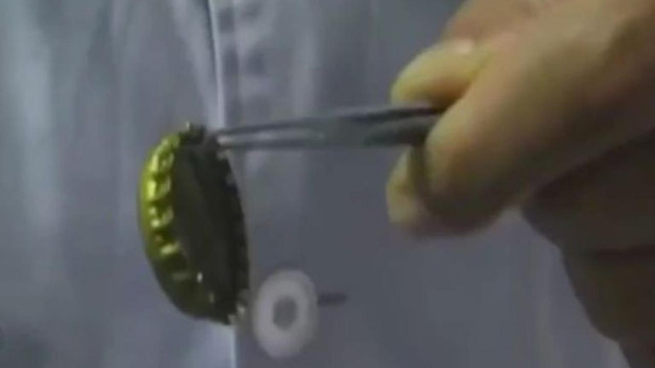 Gunakan Kondom, Dokter Keluarkan Tutup Botol dari Perut Pasien