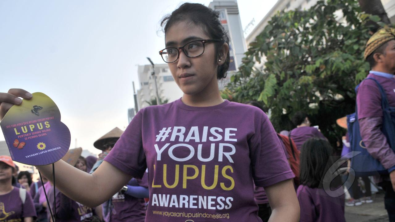 Peringatan Hari Lupus Warnai Car Free Day