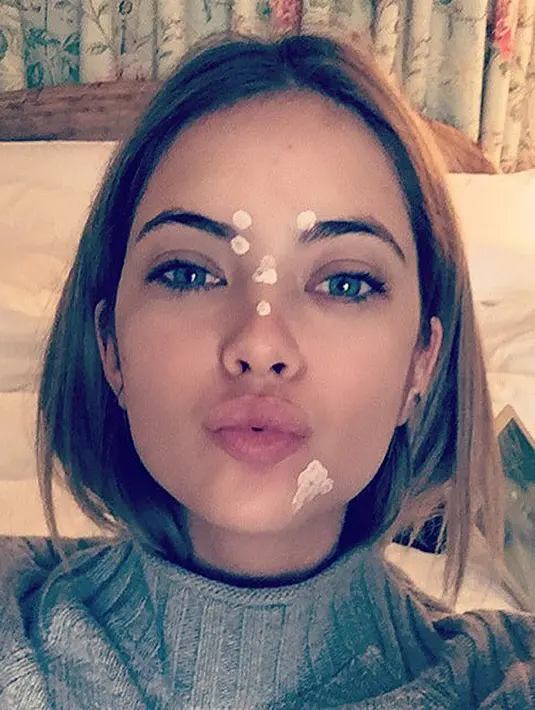 Ashley Benson memamerkan wajahnya yang tengah dalam perawatan jerawat lewat akun Instagram. (instagram/HollywoodLife)