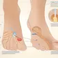 Periksa Kaki Anda! 7 Tanda Awal Diabetes yang Harus Diwaspadai (Ilustrasi Tanda Awal Diabetes di Kaki by AI)