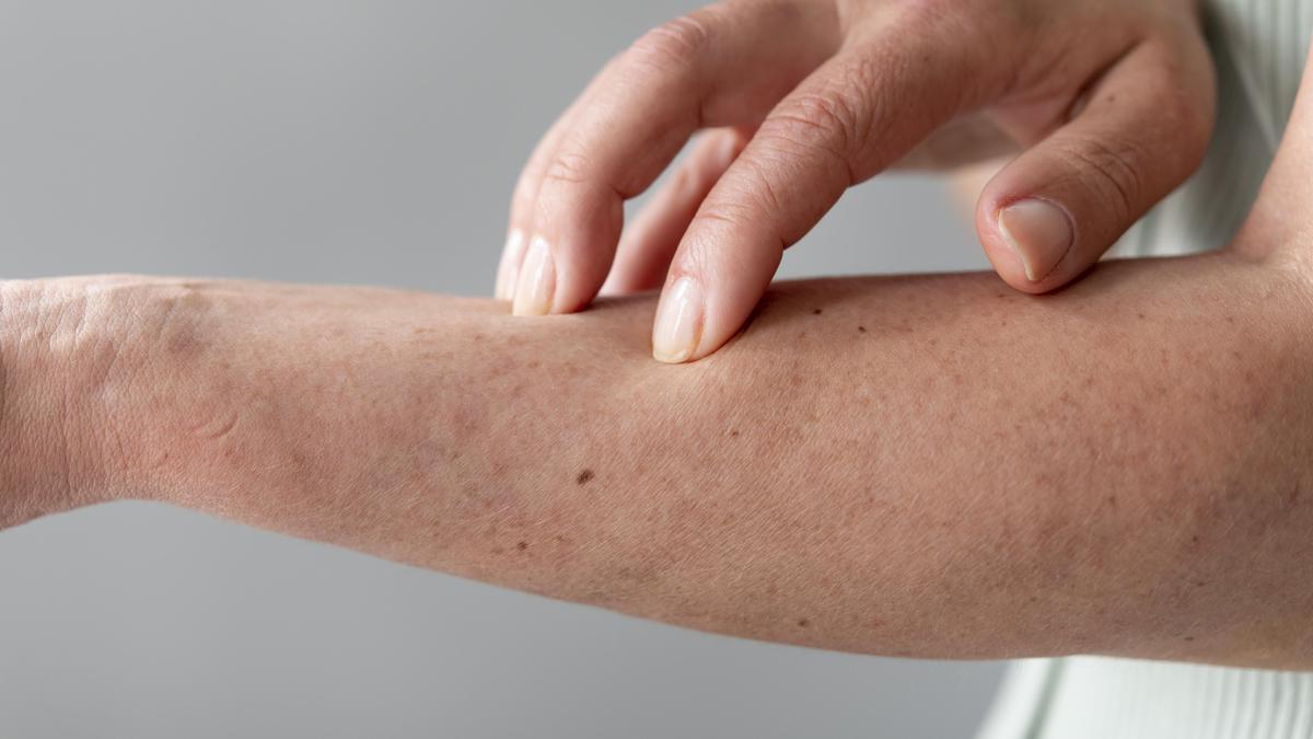 Kulit Sering Kering? Bagaimana Cara Menjaganya agar Tetap Lembap