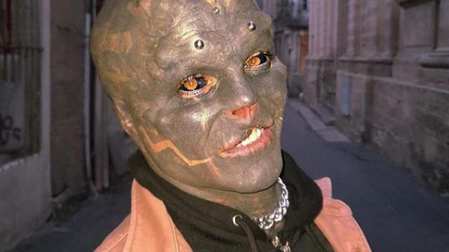 Terobsesi Menjadi Alien, Pria Ini Lakukan Modifikasi Ekstrem pada Tubuhnya