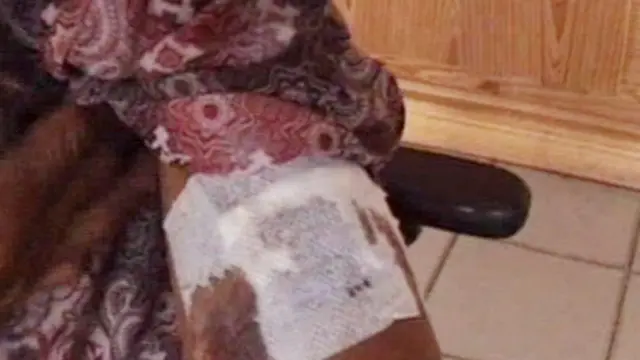 Pekerja Bangunan Korban Bom Bunuh Diri Poso Trauma