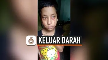 vertical keluar darah