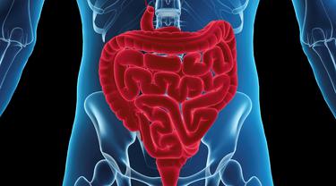 5 Fakta Kanker Usus Besar