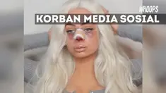 Karolina ingin lakukan protes sosial di masyarakat karena cantik tak perlu lakukan banyak perubahan fisik yang membahayakan.
