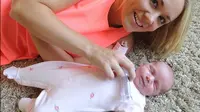 Ini dia Rose, bayi yang terlahir dengan dua gigi (Foto: Daily Mail)