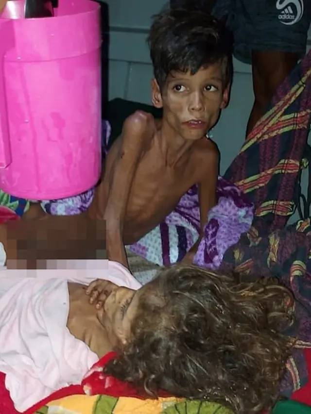Kisah Dua Bocah Sebulan Tersesat di Hutan Amazon, Bertahan dengan Minum Air Hujan