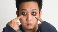 7 Cara Alami dan Mudah Menghilangkan Mata Panda