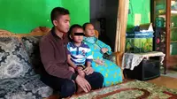 Seorang bocah di Probolinggo mengalami kejadian aneh, alat kelaminnya tersunat begitu saja tanpa bantua medis.(Dian Kurniawan/ Liputan6.com)