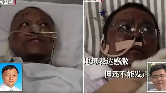 kulit dua dokter berubah jadi cokelat karena covid-19