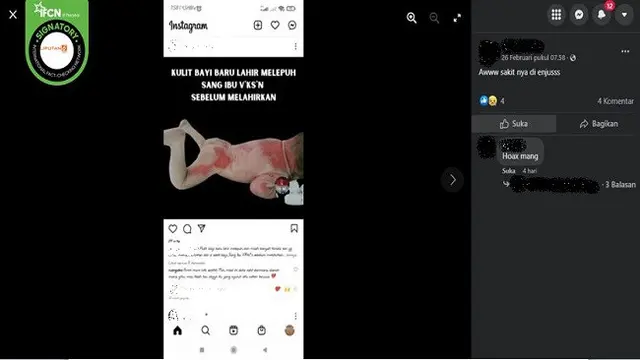 Gambar Tangkapan Layar Klaim Kulit Bayi Melepuh karena Sang Ibu Disuntik Vaksin COVID-19 (sumber: Facebook).