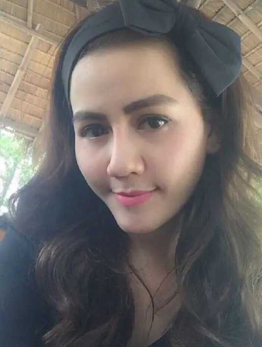 nITA tALIA yang dulu berpipi tembem, sekarang sudah tirus, hidungnya mancung. dagu lancip. Sementara kantung mata nyaris tak terlihat. (Via Instagram/@nita.talia)