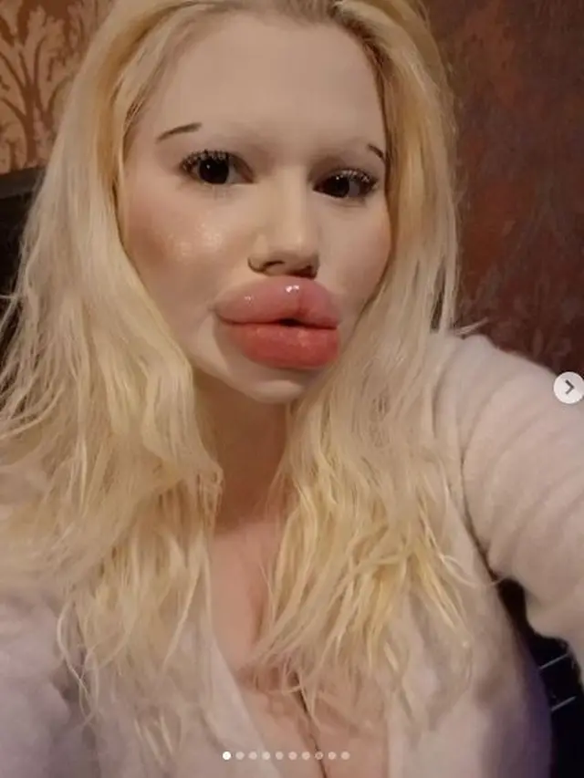 6 Foto Terkini Andrea Ivanova Wanita Viral Bibir Terbesar, Kini Rambutnya Pirang