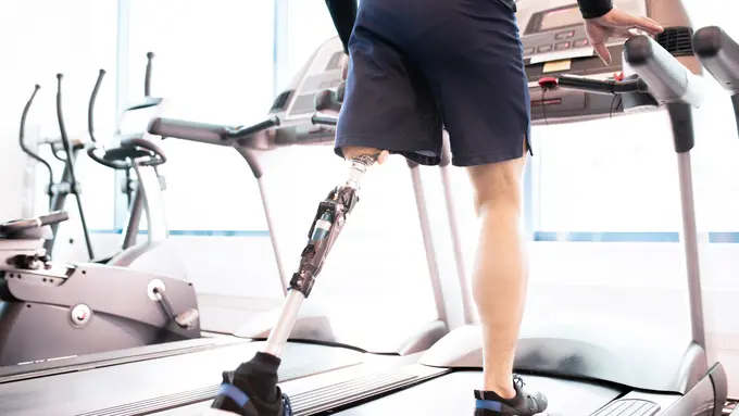 Ilustrasi kehilangan kaki