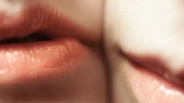 [Fimela] Bibir Pecah-pecah