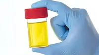 Penelitian terbaru menemukan urine itu tidak steril sehingga siapapun yang senang minum urine berpikirlah kembali.