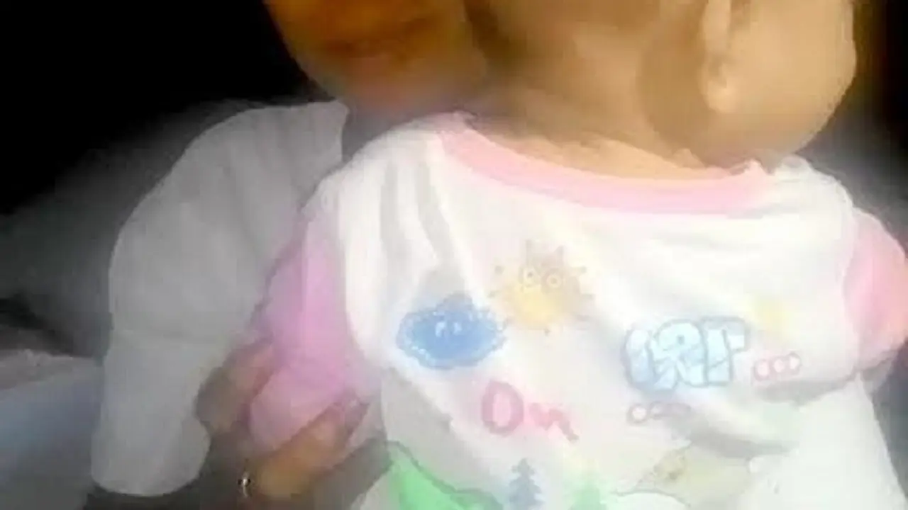 Benjolan Misterius di Kepala Bayi 8 Bulan