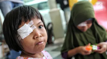 Seorang pasien anak diperban mata kanannya untuk mendapatkan bola mata palsu gratis di Klinik Ilyarsi Okularis, Villa Bintaro Indah, Tangsel, Selasa (15/5). Sebanyak 23 mata palsu dibagikan pada Gerakan 1.000 Mata Palsu Gratis. (Liputan6.com/Fery Pradolo)