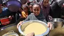 Saat ini, situasi terus memburuk. Berbagai laporan menunjukkan lonjakan signifikan jumlah anak-anak yang mengalami kekurangan gizi akut, sebagian besar di antaranya tidak memiliki akses perawatan medis dasar maupun nutrisi. (Omar AL-QATTAA/AFP)